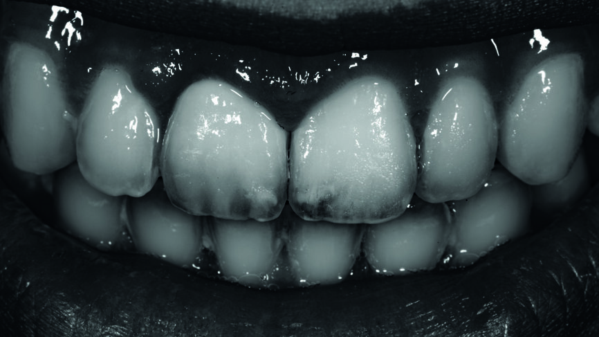 Fig. 16 : Vérification de la luminosité du résultat final. 