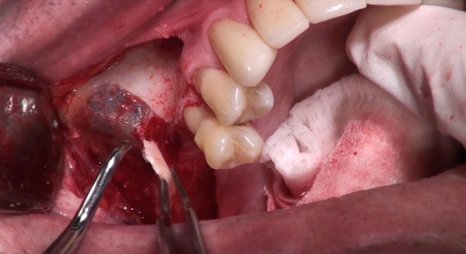 Î Î­Î¾ÏÏÎ½Î· ÏÎµÏÎ½Î¹ÎºÎ® ÏÎ¿ÏÎ¿Î¸Î­ÏÎ·ÏÎ·Ï ÎµÎ¼ÏÏÏÎµÏÎ¼Î±ÏÎ¿Ï IDR