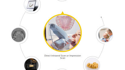 002-direct-intraoral-scan-or-impression-scan