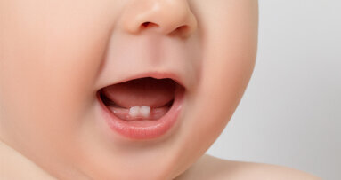 Prävention frühkindlicher Karies: Neue Leistungen ab 1. Juli 2019