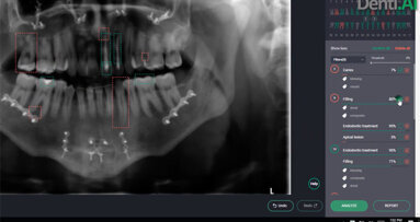 La recherche clinique décerne un premier prix à l’intelligence artificielle