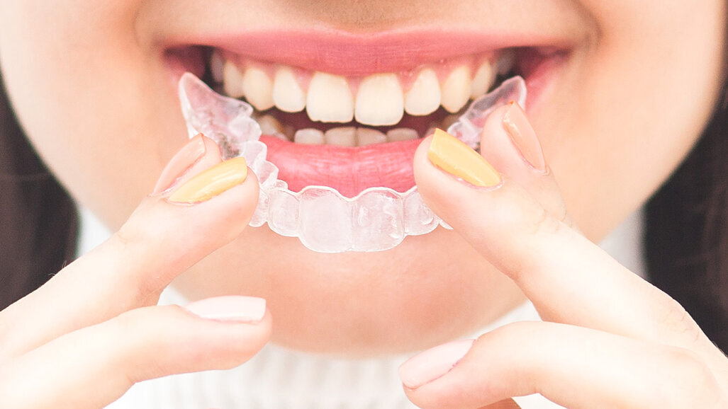 SmileDirectClub reduz prejuízo líquido e sinaliza grande mudança de estratégia para 2022