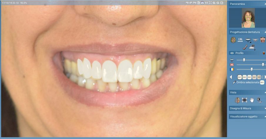 Fig. 2 - Previsualizzazione digitale.