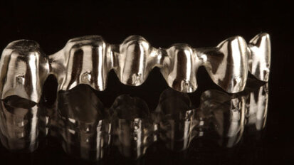 NobelProcera : Des restaurations fraisées avec précision