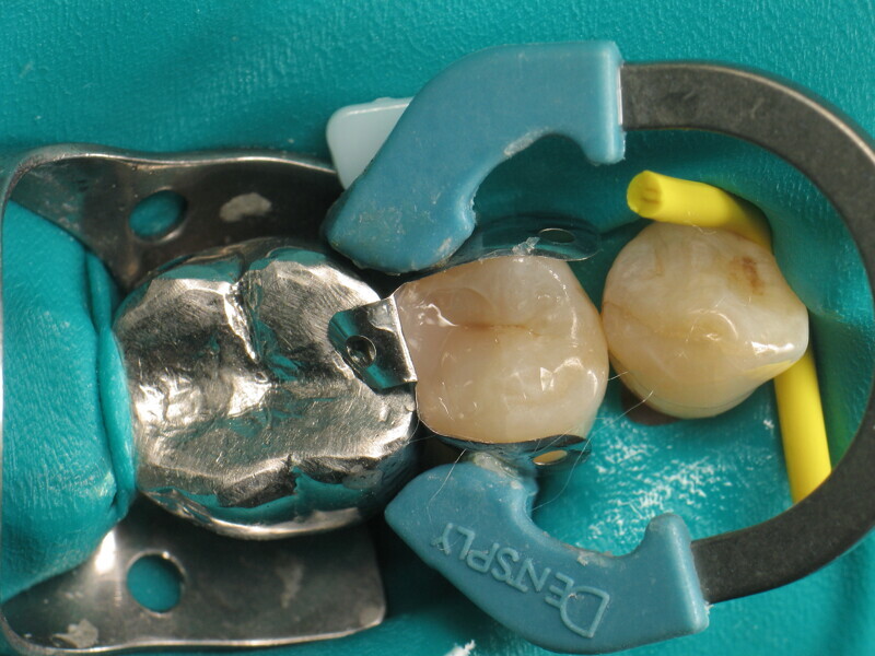 Fig. 15 : Maquillage au FinalTouch.