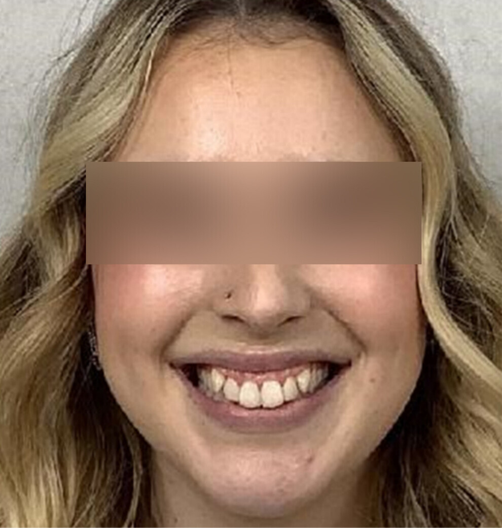 Fig. 1: Initial photograph.