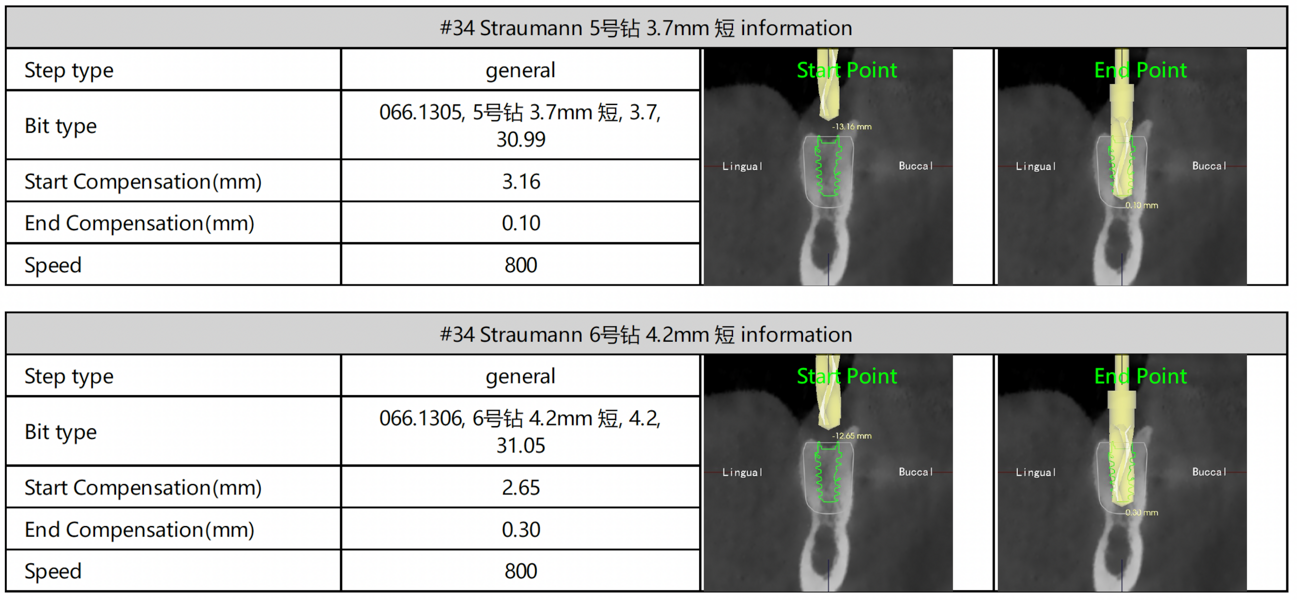 Fig. 12: Drilling plan for site #34 showing bur selection, rotational speed and planned drilling depth for sequential osteotomy preparation.