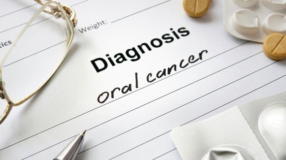 Visualização de fluorescência poderia melhorar as taxas de recidiva do câncer bucal