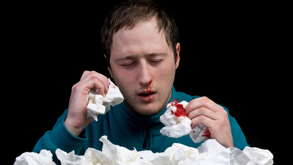 Nasenbluten enthüllt abwegigen Zahn