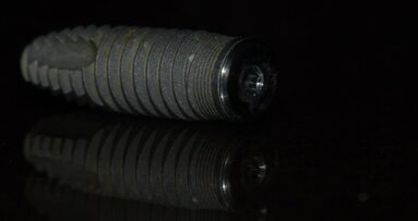 Ultrasonic scaling of titanium implants can trigger Peri-implantitis, indicates latest study