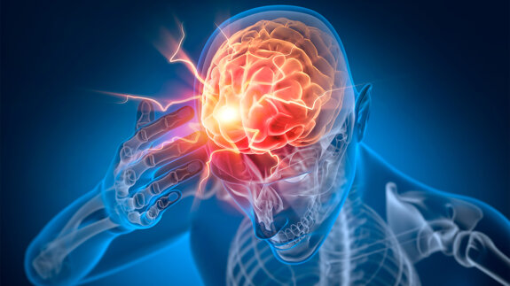 Schlechte Mundgesundheit als Risikofaktor für Schlaganfälle und Herz-Kreislauf-Ereignisse