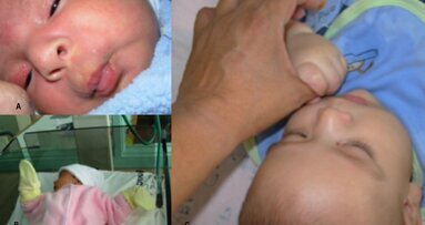 La importancia del desarrollo psicomotor del lactante