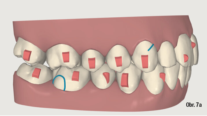 Kazuistika - popis v textu