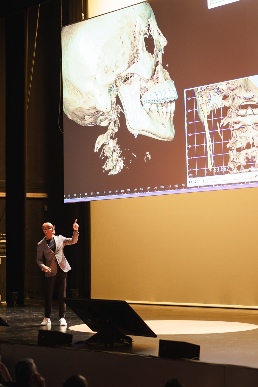 The topic of occlusion in the digital workflow was discussed with master dental technician Edris Rasta from the Netherlands. (Image: exocad)