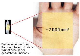 EMS – AIRFLOW Kills Biofilm