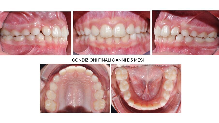 Fig. 9_Fotografie occlusali postrattamento.
