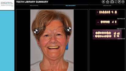 EGS ad IDS 2015: ecco le ultime novità CAD/CAM per il Digital Dentistry