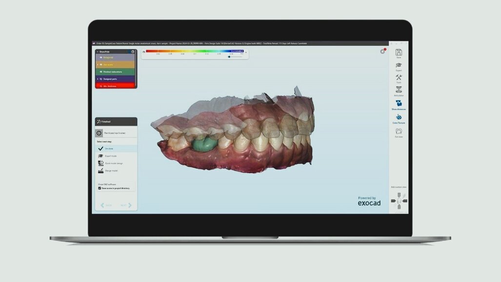 Align Technology introduces iTero Design Suite