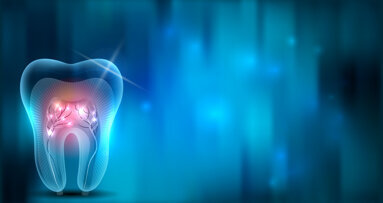 Piezoceramic stack actuator speeds up root canal treatment