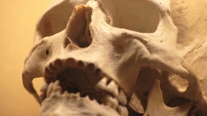 Drukowane implanty z PW pomagają w odbudowie kości