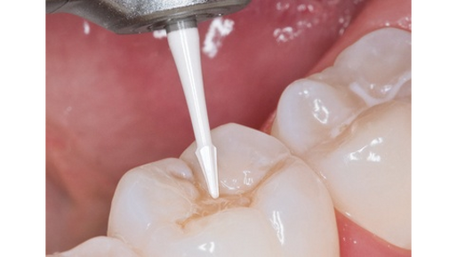 La linea CeraLine Komet si arricchisce di nuovi articoli