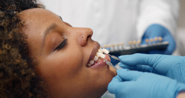 Align Technology introduces its first professional whitening system in the UK