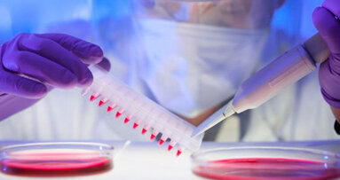 Ricercatori del dentale impegnati a perfezionare il test dell’HIV nei Paesi in via di sviluppo