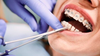 Startschuss für die Facharztausbildung für Kieferorthopädie