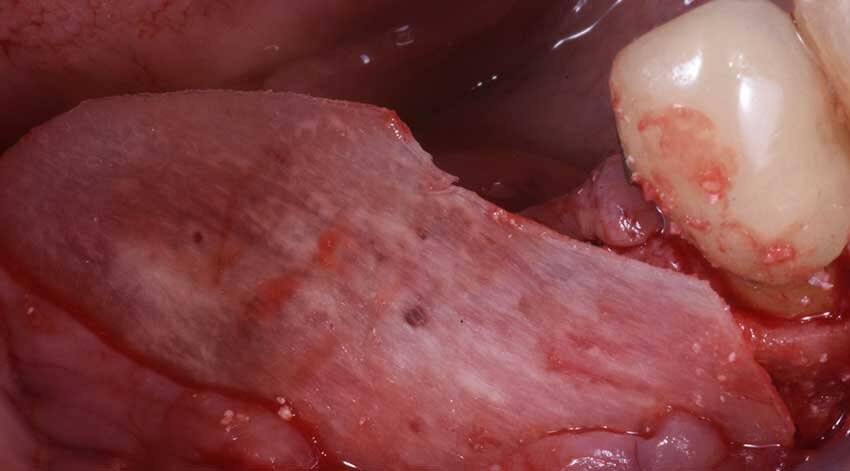 Fig. 7 - Lamina inserita.