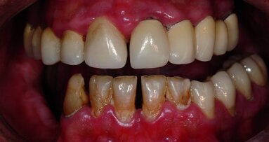 Apport des nouvelles technologies pour le traitement d’un cas complexe