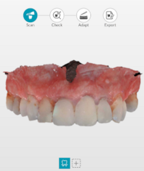 Figs. 4a–c: Digital impressions of the initial situation.