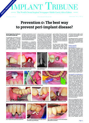 Implant Tribune Middle East & Africa No. 3, 2019
