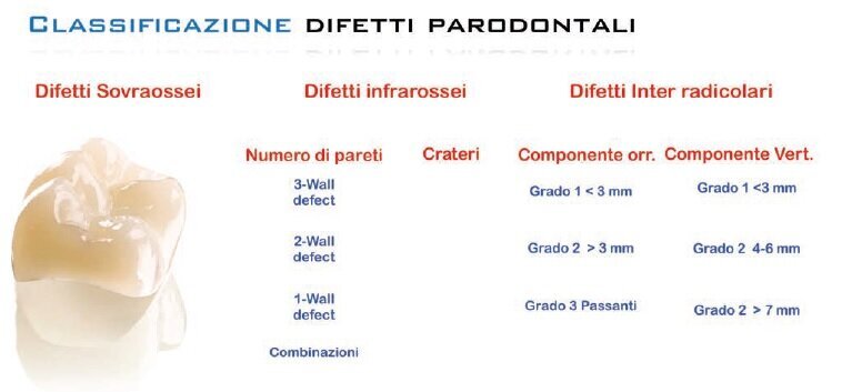 Fig. 1 - Classificazione dei difetti parodontali.