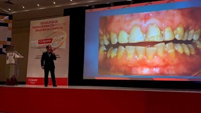 El diseño de sonrisa extremo