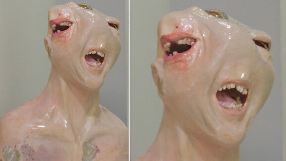 Bessere Mundhygiene durch Schock-Skulptur?