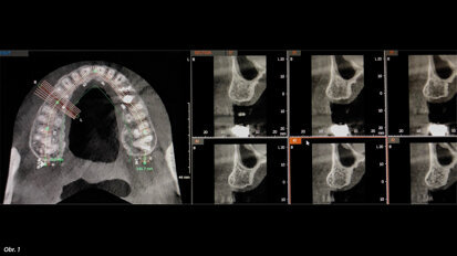 JMDC organises special session on CBCT