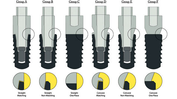 Canine study finds implant-abutment interface configuration may influence crestal bone changes