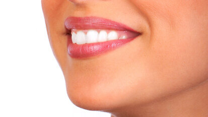 White wine can increase tooth staining