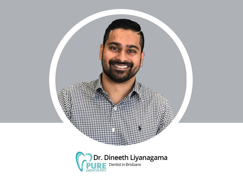 pure dentistry-dr-dineeth-liyanagama