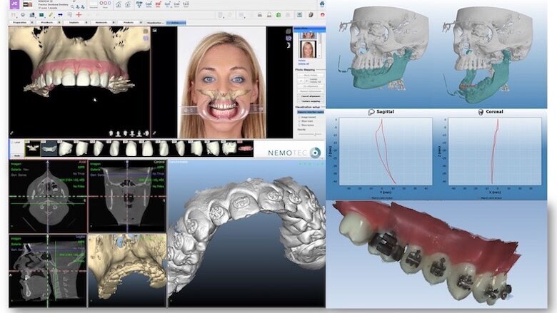 Ortodoncia Digital: ¿Una revolución solo tecnológica?