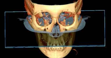 The role of 3-D imaging systems in present orthodontics
