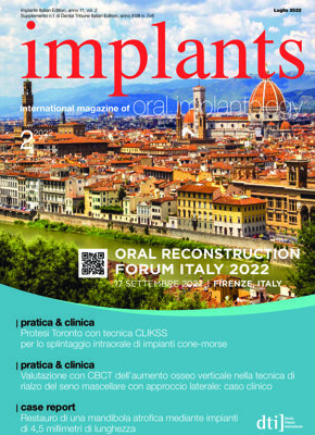 implants Italy No. 2, 2022 implants Italy No. 2, 2022