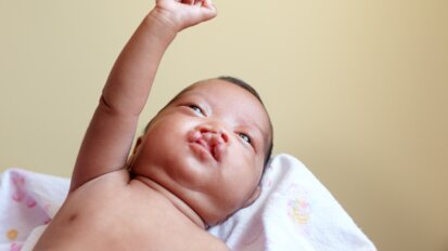 CBCT voor kinderen met schisis kan met minder hoge stralingsdosis