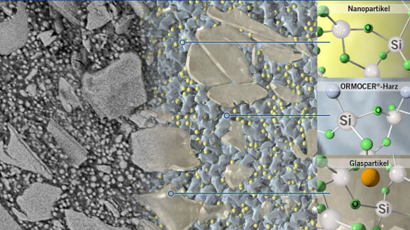 Webinar präsentiert Wissenswertes zu neuartigem Füllungsmaterial