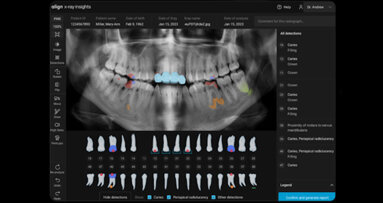 Align Technology introduces new software innovations designed to accelerate digital practice transformation