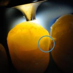 Fig. 5 - Un grande aiuto per il rilevamento della carie: l'emissione luminosa focalizzata di 1 mm della nuova punta per transilluminazione SmartLite Pro (©Dentsply Sirona).