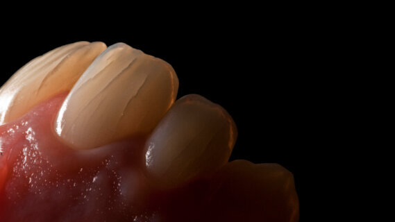 Photographie dentaire numérique