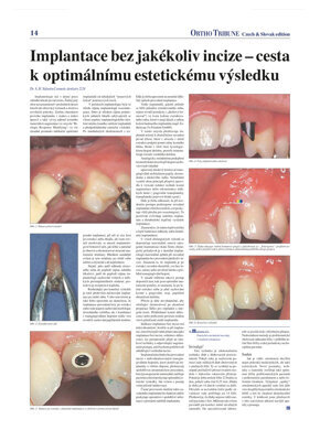 DT Czech and Slovak Republic