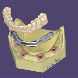 Exocad launches DentalCAD 3.3 Chemnitz
