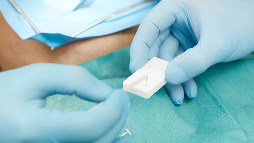 The enduring legacy of MDP monomer